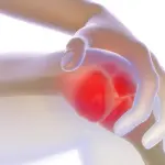 La Gonartrosi (artrosi del Ginocchio)